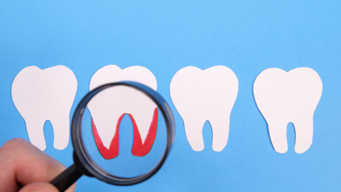 The Power of Probiotics in Treating Gum Recession and Supporting Oral Hygiene